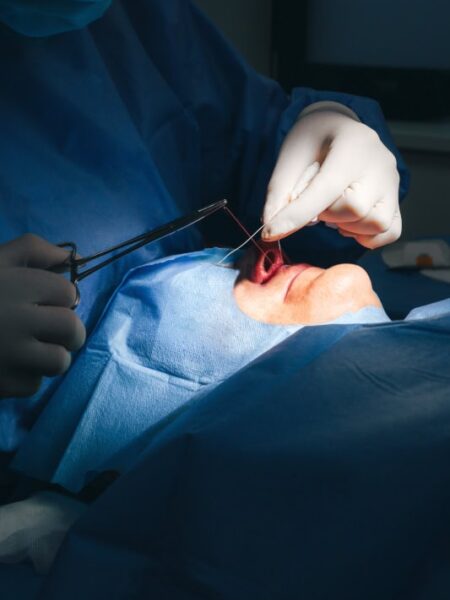 Otoplastyka – korekta odstających uszu metodą chirurgiczną