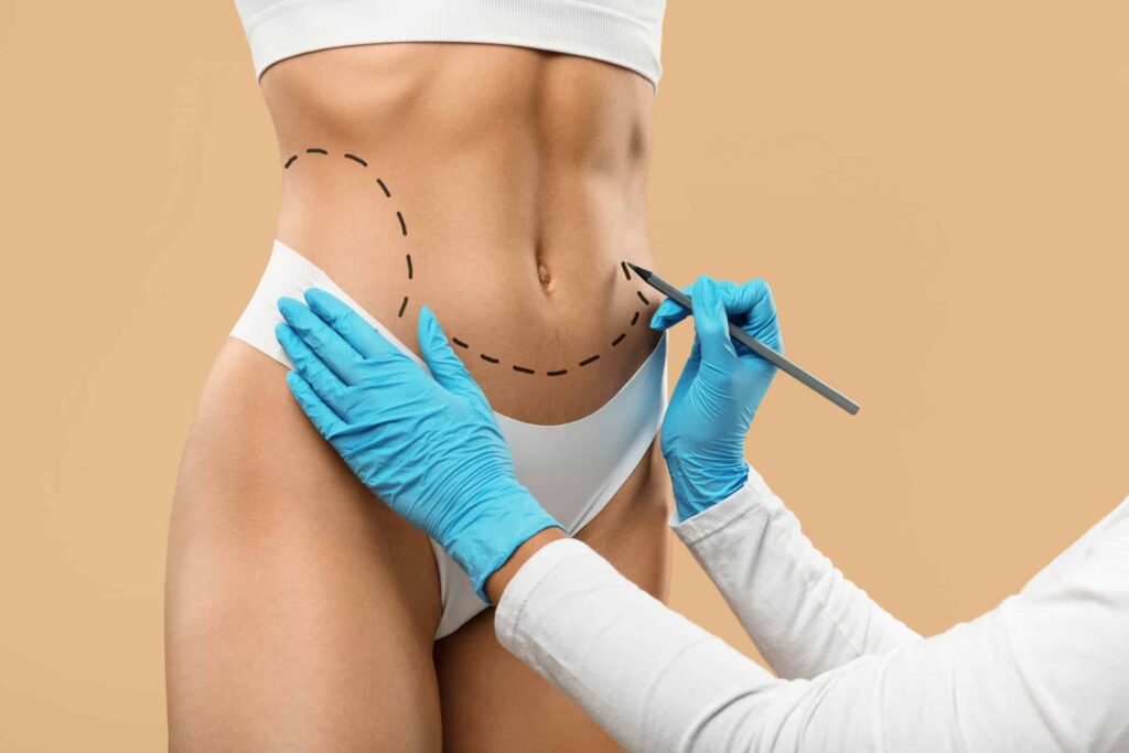 rekonwalescencja po liposukcji